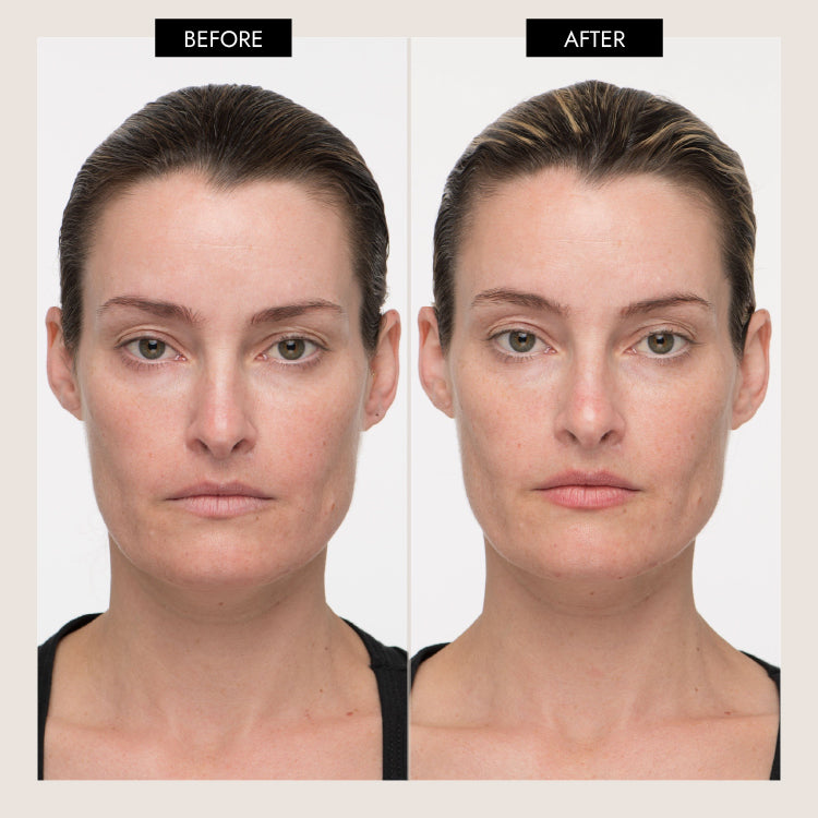 MyoLift™ QT Plus Facial Toning Device & Ghost Democracy